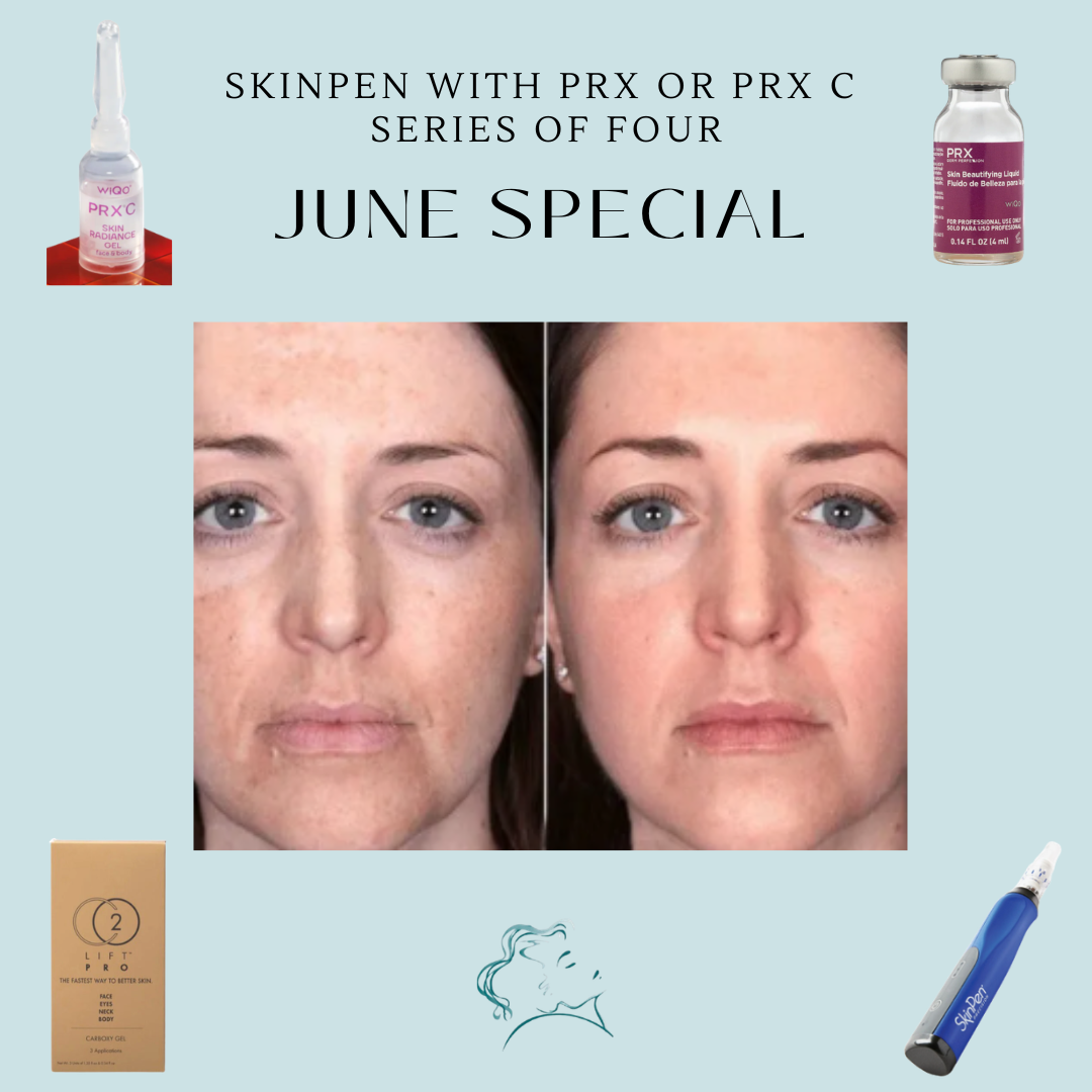 June Glow Revival